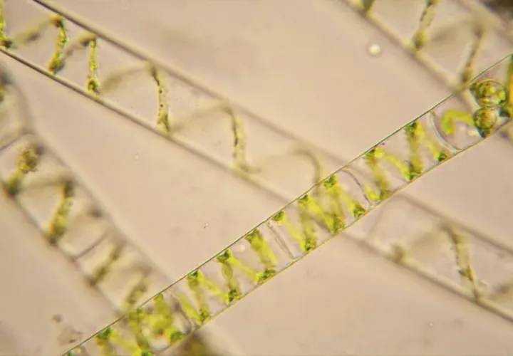 Imagen de un alga cuerno de ciervo vista al microscopio.