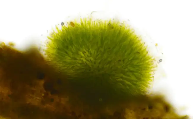 Detalle microscópico de la Cyanobacteria